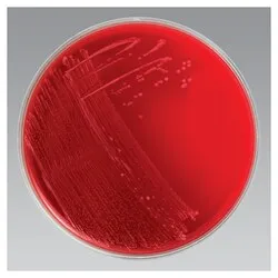 Anaerobic Blood Agar